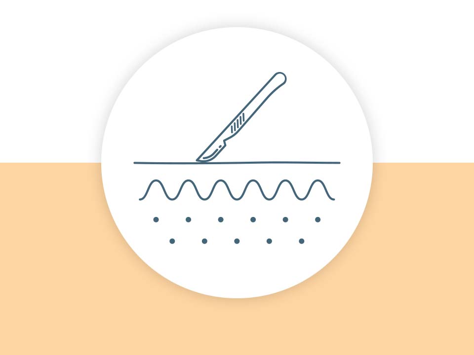 Icon für Operationen und Laserbehandlungen in der Dermatologie