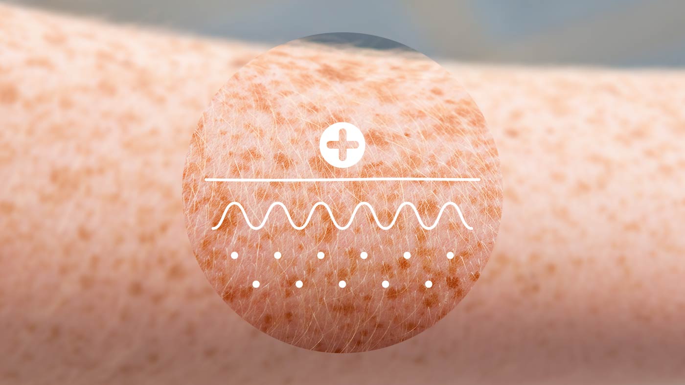 Arm mit Sommersprossen