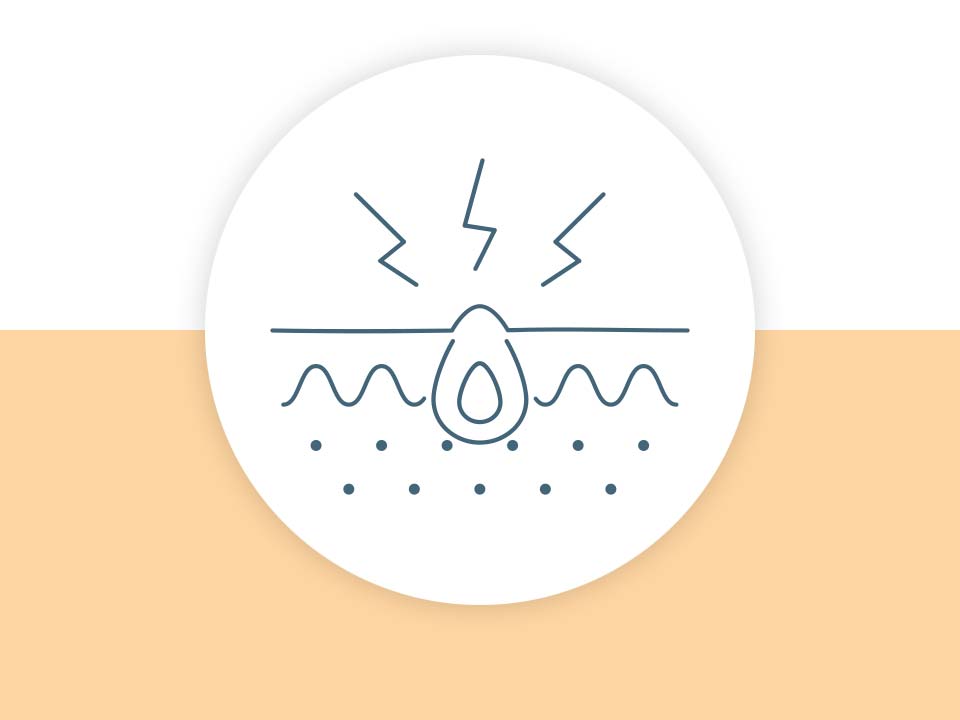 Icon für Hautkrankheit Akne