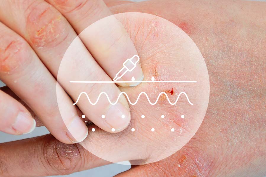 allergologischen Diagnostik